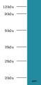 Major urinary proteins 11 and 8 antibody, A54563-100, Epigentek, Western Blot image 