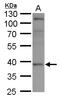 X-Ray Repair Cross Complementing 3 antibody, GTX103999, GeneTex, Western Blot image 