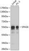 Sperm Associated Antigen 6 antibody, 18-936, ProSci, Western Blot image 