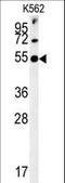 Synaptotagmin 13 antibody, LS-C161651, Lifespan Biosciences, Western Blot image 