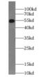 SS18L1 Subunit Of BAF Chromatin Remodeling Complex antibody, FNab01971, FineTest, Western Blot image 