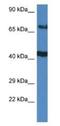 TNFAIP3 Interacting Protein 1 antibody, NBP1-79899, Novus Biologicals, Western Blot image 