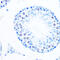 DNA Polymerase Beta antibody, GTX02848, GeneTex, Immunohistochemistry paraffin image 