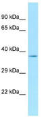 Ankyrin Repeat Family A Member 2 antibody, TA339754, Origene, Western Blot image 