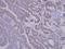 Sorting nexin-12 antibody, GTX106456, GeneTex, Immunohistochemistry paraffin image 