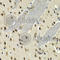 MYC Associated Factor X antibody, A2157, ABclonal Technology, Immunohistochemistry paraffin image 