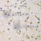CCNG1 antibody, A5292, ABclonal Technology, Immunohistochemistry paraffin image 