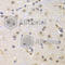 Cyclin-G1 antibody, A5292, ABclonal Technology, Immunohistochemistry paraffin image 