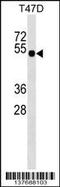 GLI Family Zinc Finger 4 antibody, 59-335, ProSci, Western Blot image 