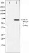 Zeta Chain Of T Cell Receptor Associated Protein Kinase 70 antibody, orb106158, Biorbyt, Western Blot image 