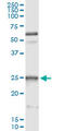 Heat Shock Protein Family B (Small) Member 1 antibody, LS-C197469, Lifespan Biosciences, Immunoprecipitation image 