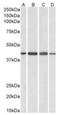 ArfGAP With Dual PH Domains 1 antibody, NB300-907, Novus Biologicals, Western Blot image 