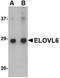 ELOVL Fatty Acid Elongase 6 antibody, orb74978, Biorbyt, Western Blot image 