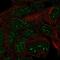 TRNA Methyltransferase 11 Homolog antibody, NBP2-57607, Novus Biologicals, Immunocytochemistry image 