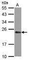 Glucosamine-Phosphate N-Acetyltransferase 1 antibody, NBP2-16702, Novus Biologicals, Western Blot image 