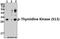 Thymidine Kinase 1 antibody, A04850S13, Boster Biological Technology, Western Blot image 