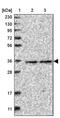 Rab Geranylgeranyltransferase Subunit Beta antibody, PA5-55352, Invitrogen Antibodies, Western Blot image 