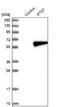 Intraflagellar Transport 57 antibody, NBP1-84788, Novus Biologicals, Western Blot image 