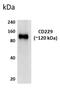 Lymphocyte Antigen 9 antibody, GTX52616, GeneTex, Western Blot image 