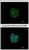 Keratin 13 antibody, NBP2-16086, Novus Biologicals, Immunocytochemistry image 