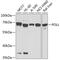 DNA Polymerase Lambda antibody, 23-563, ProSci, Western Blot image 