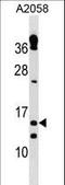 Thioredoxin reductase 3 intronic transcript 1 antibody, LS-C157303, Lifespan Biosciences, Western Blot image 