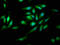 Pyridoxamine 5'-Phosphate Oxidase antibody, LS-C673899, Lifespan Biosciences, Immunofluorescence image 