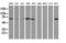 Epsin 2 antibody, LS-C786883, Lifespan Biosciences, Western Blot image 