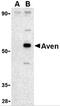 Apoptosis And Caspase Activation Inhibitor antibody, 2413, ProSci, Western Blot image 