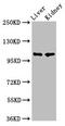 Platelet Endothelial Aggregation Receptor 1 antibody, CSB-PA017765LA01HU, Cusabio, Western Blot image 