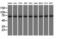Kelch Repeat And BTB Domain Containing 7 antibody, M14135, Boster Biological Technology, Western Blot image 