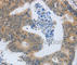 Matrix Metallopeptidase 8 antibody, A3031, ABclonal Technology, Immunohistochemistry paraffin image 