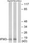 Interferon Induced Transmembrane Protein 3 antibody, abx014007, Abbexa, Western Blot image 