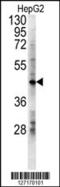 Lactate Dehydrogenase D antibody, 62-026, ProSci, Western Blot image 
