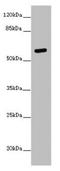 Protein Arginine Methyltransferase 3 antibody, LS-C682236, Lifespan Biosciences, Western Blot image 