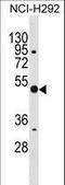 Annexin A10 antibody, LS-C159077, Lifespan Biosciences, Western Blot image 