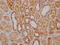 NADH:Ubiquinone Oxidoreductase Core Subunit S3 antibody, CSB-RA224121A0HU, Cusabio, Immunohistochemistry paraffin image 