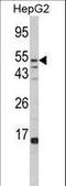 Alpha-L-Fucosidase 1 antibody, LS-B9324, Lifespan Biosciences, Western Blot image 