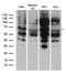 Erythropoietin Receptor antibody, LS-C796629, Lifespan Biosciences, Western Blot image 