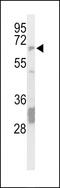 Protein Tyrosine Phosphatase Non-Receptor Type 5 antibody, MBS9204706, MyBioSource, Western Blot image 