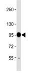 Cartilage Oligomeric Matrix Protein antibody, GTX81660, GeneTex, Western Blot image 