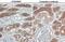 Angiotensin I Converting Enzyme 2 antibody, GTX635897, GeneTex, Immunohistochemistry paraffin image 
