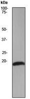 Stathmin 1 antibody, ab52630, Abcam, Western Blot image 