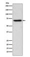 IL2 Inducible T Cell Kinase antibody, M01385, Boster Biological Technology, Western Blot image 