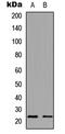 NADH:Ubiquinone Oxidoreductase Subunit B9 antibody, abx121532, Abbexa, Western Blot image 