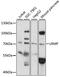 Lymphoid Restricted Membrane Protein antibody, LS-C749379, Lifespan Biosciences, Western Blot image 