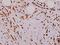 Thyroid Hormone Receptor Alpha antibody, A01775-1, Boster Biological Technology, Immunohistochemistry paraffin image 