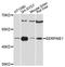 Serpin Family E Member 1 antibody, abx126530, Abbexa, Western Blot image 