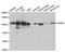 Proteasome 26S Subunit, Non-ATPase 2 antibody, abx001625, Abbexa, Western Blot image 