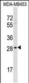 Axin Interactor, Dorsalization Associated antibody, PA5-48884, Invitrogen Antibodies, Western Blot image 